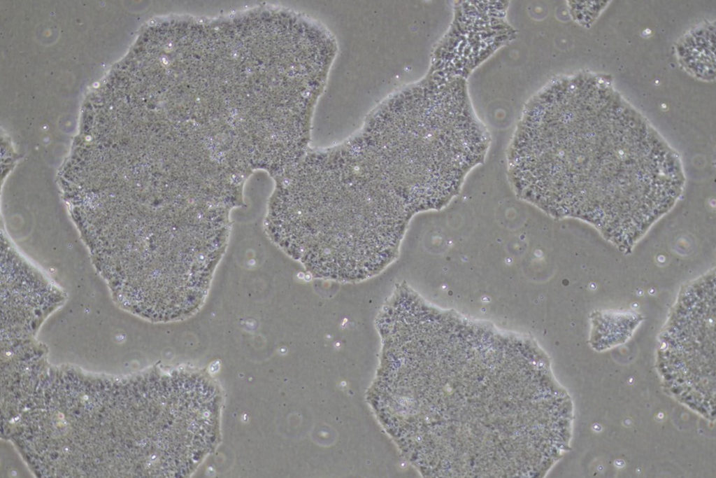 Induzierte pluripotente Stammzellen (iPSCs)