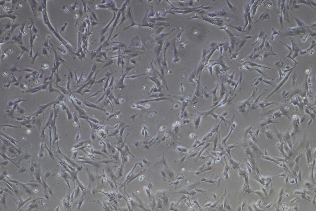 Células madre mesenquimales (MSC)