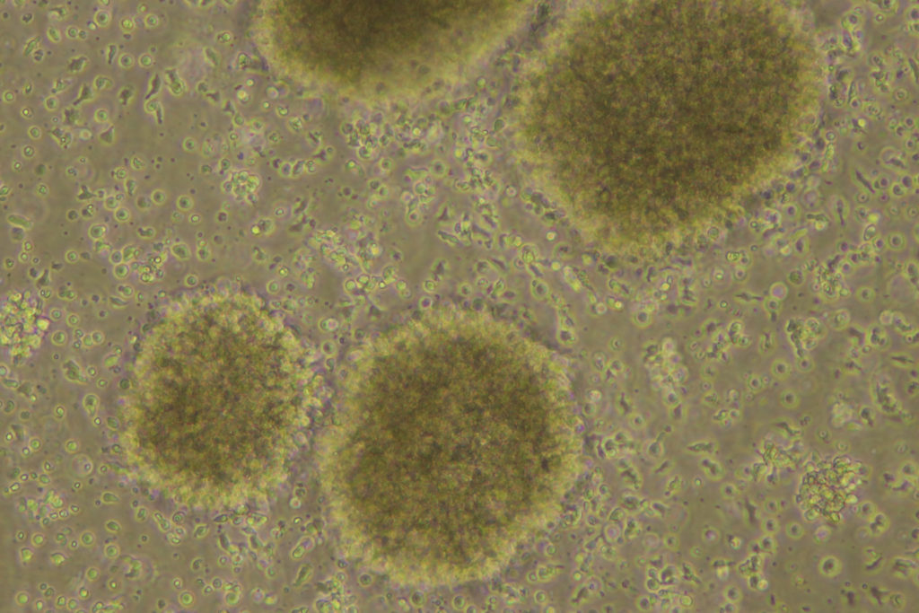 Células asesinas naturales (células NK)